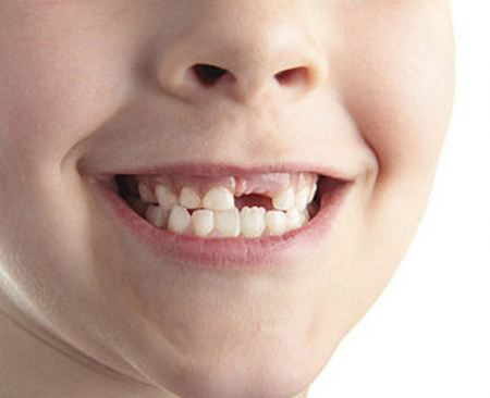 تفسير حلم سقوط الأسنان في اليد للمتزوجه